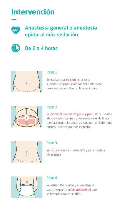 Intervención de la abdominoplastia