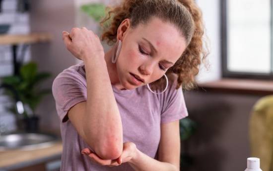 ¿Existe la alergia al sol?