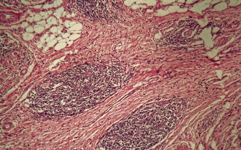 Anatomía patológica digital