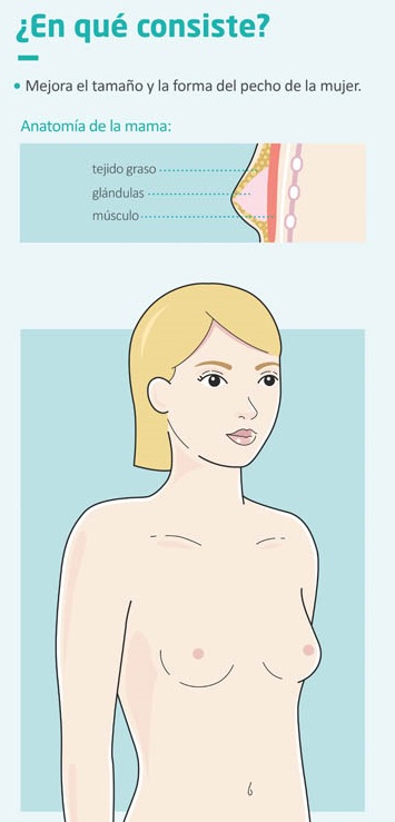 Aumento de pecho, ¿en qué consiste?