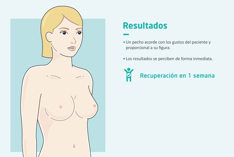 Resultados del aumento de pecho o mamoplastia