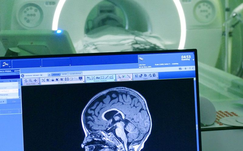 Avances en el estudio del cerebro pediátrico