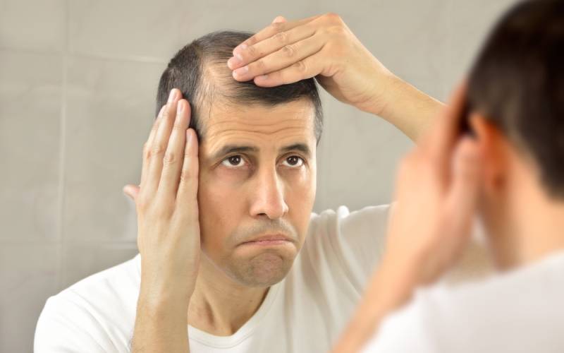 Causas y tratamientos de la alopecia