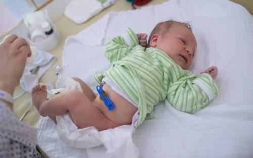 Aprende a limpiar el cordón umbilical del neonato en casa