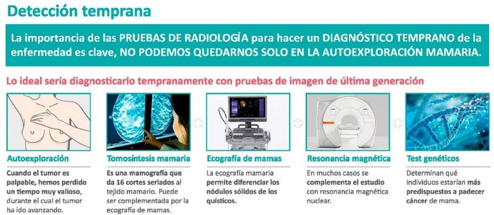 La detección precoz en el cáncer de mama