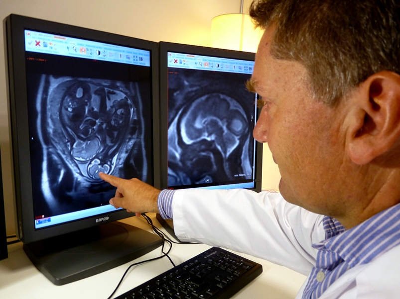 diagnostico-precoz-resonancia-magnetica-fetal