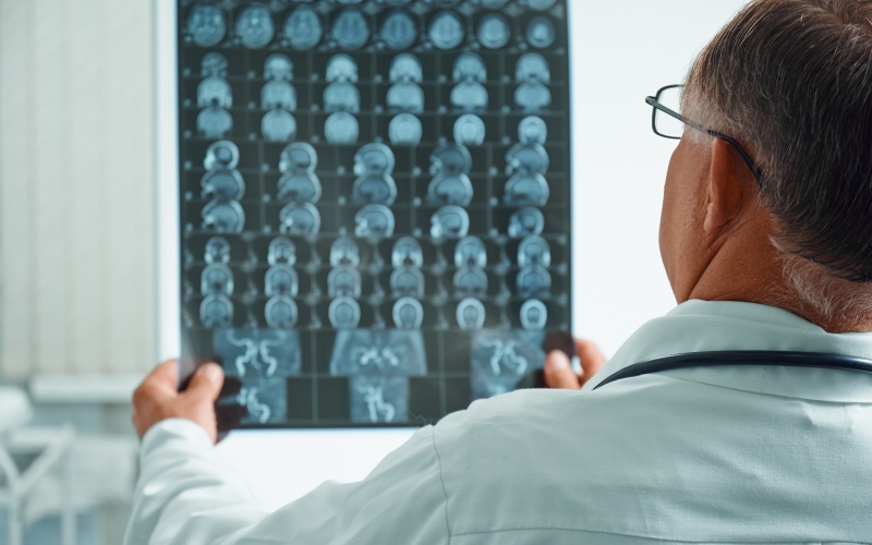 diagnostico-precoz-rmn