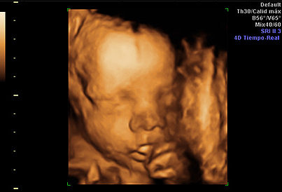 Ecografía 4d del tercer trimestre