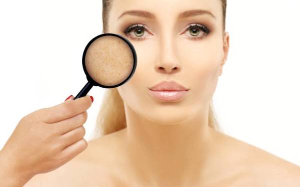 Cómo eliminar manchas solares