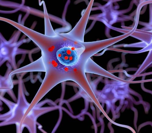 Parkinson: síntomas, causas y tratamientos