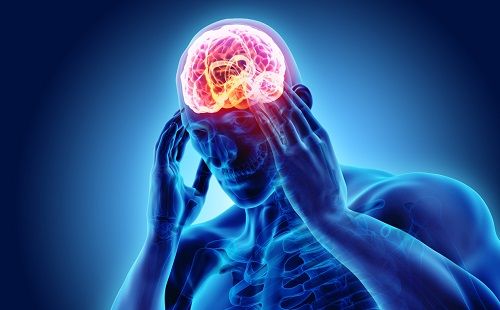 Especial sobre la migraña con consejos para vivir mejor