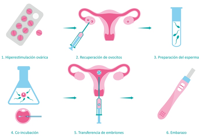 Procedimiento de Fecundación in vitro o FIV