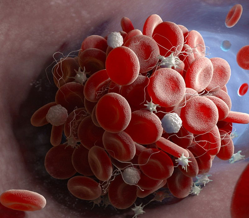 ¿Qué efectos causa la Covid-19 en el corazón?