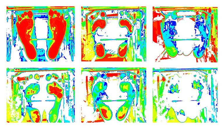 Imágenes obtenidas de un podoscopio