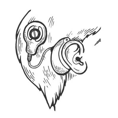 Dibujo de implante coclear