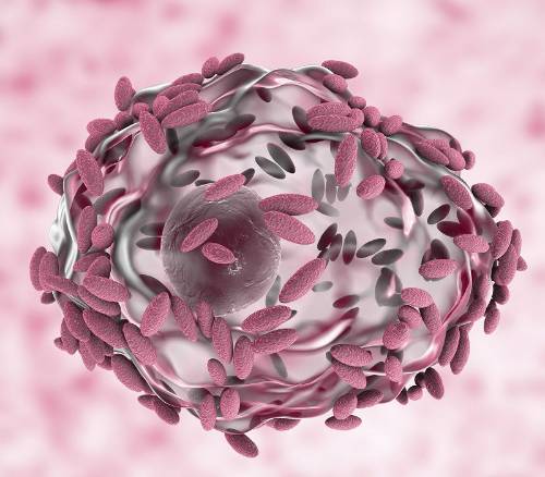 Vaginosis bacteriana, una ITS muy frecuente