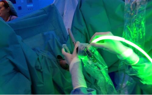 Láser en cirugía de próstata