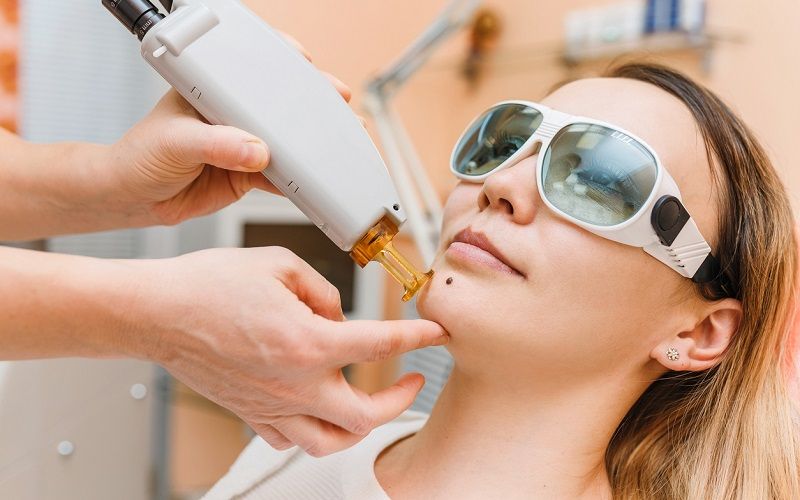 Cómo se tratan las manchas de sol