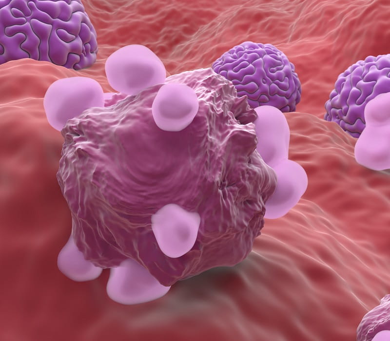 Medicina de precisión y nuevos fármacos para el cáncer de ovario