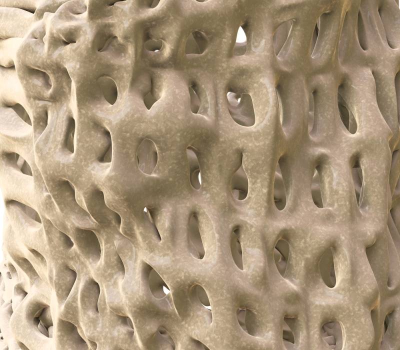 Estructura del hueso con osteoporosis