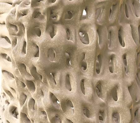 Estructura del hueso con osteoporosis