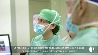 Ventajas del láser carbónico en el cáncer de laringe