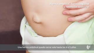 Hernia umbilical