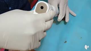 Cómo corregir la fimosis