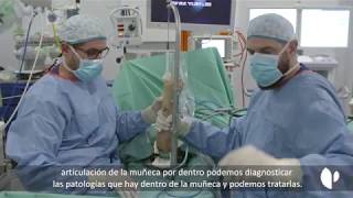 Ventajas de la artroscopia de muñeca