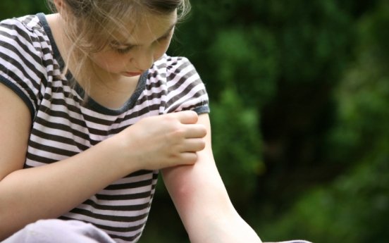 Niña muestra una picadura de mosquito