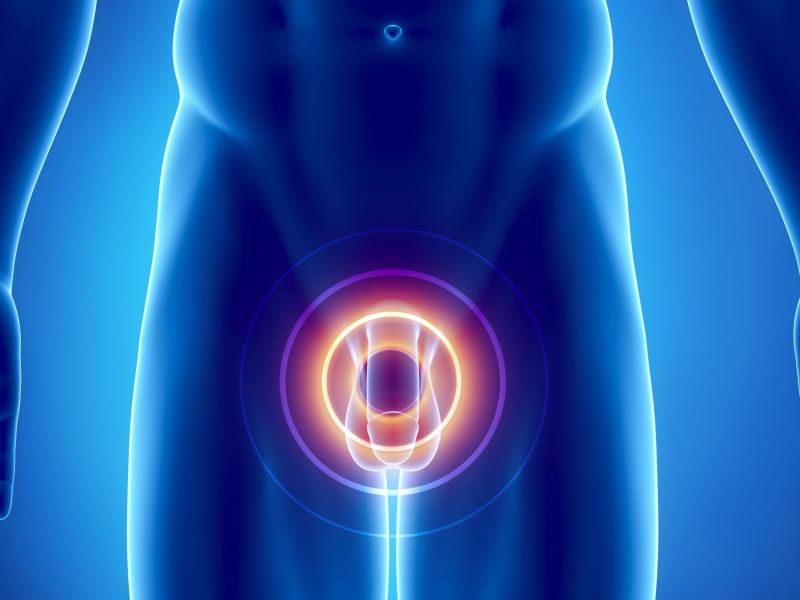 ondas-choque-disfuncion-erectil