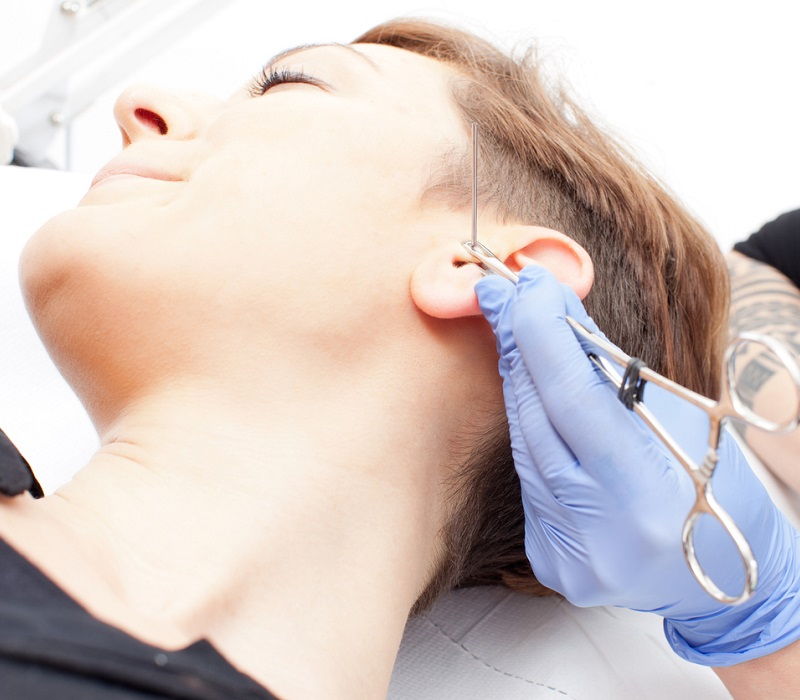 ¿Un piercing que previene las migrañas?