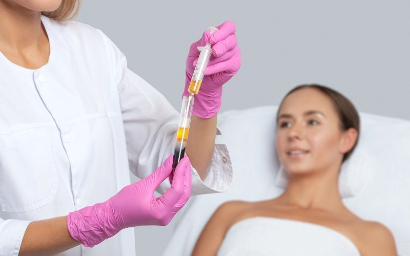 Plasma rico en plaquetas para la calvicie: cómo se realiza