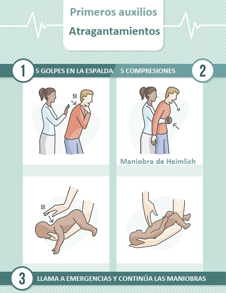 Primeros auxilios: Atragantamientos en adultos y bebés