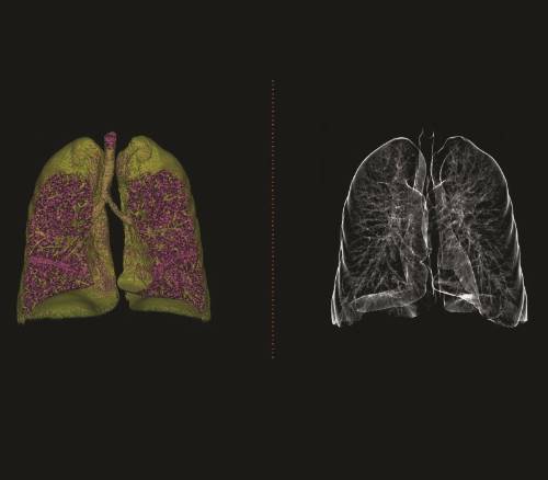 Imagen de tomografía computarizada