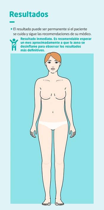 Resultados de la liposucción o lipoescultura