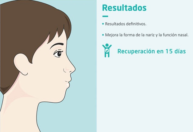 Resultados de la rinoplastia