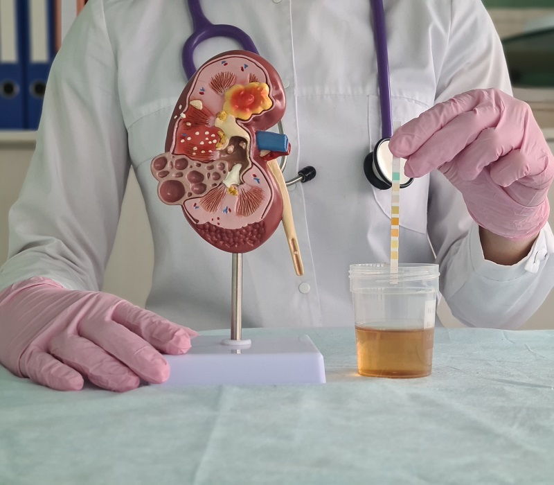 Cuál es el significado de la orina negra