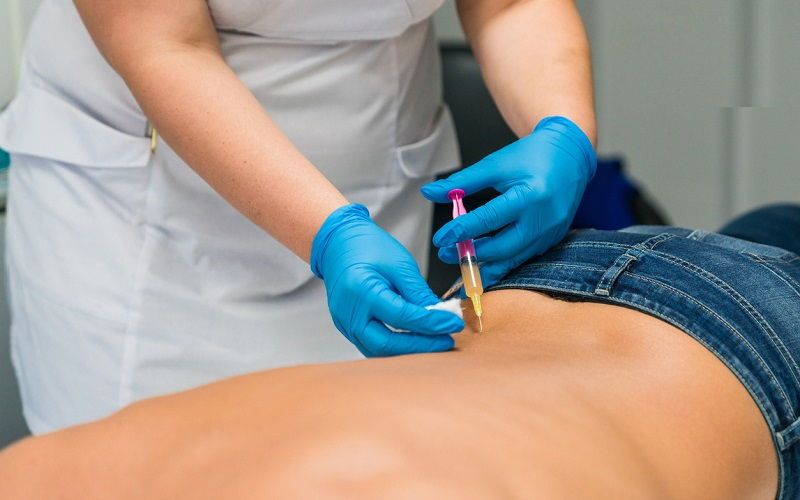 Terapia de ozono para el dolor de ciática y hernia discal