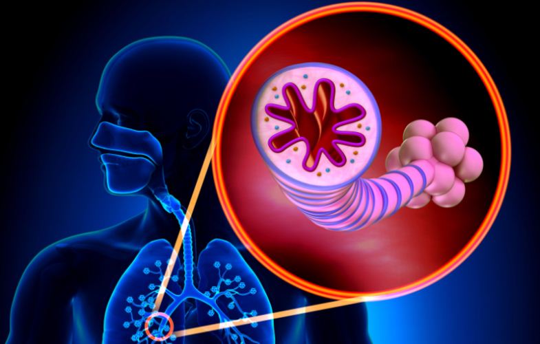 Termoplastia bronquial contra el asma