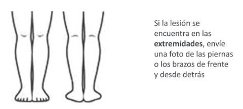 Cómo tomar la fotografía de brazos y piernas