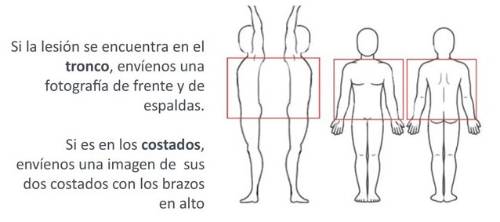 Cómo tomar la fotografía del tronco y de los costados