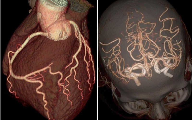 Tomografo de última generacion