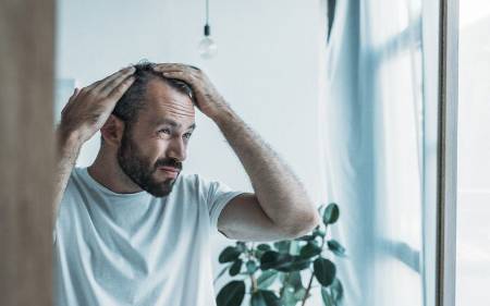 Trasplante capilar: a quién se aconseja