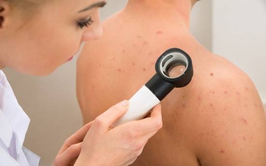 Tratamiento en la piel