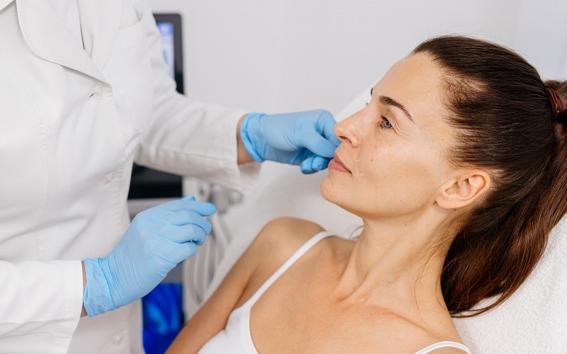 Tratamientos faciales ideales en verano y sus resultados