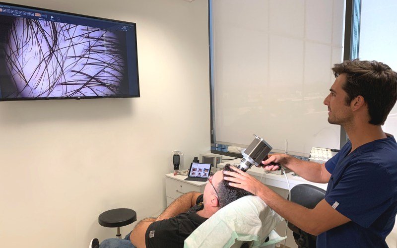 Trichoscale, un diagnóstico para la alopecia