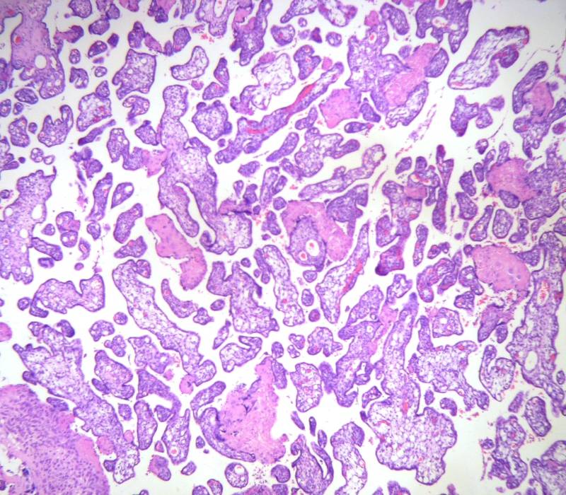 Vellosidades del tejido de la placenta