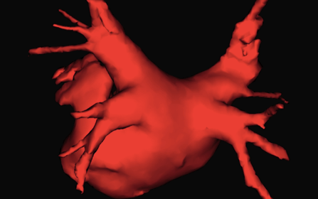 Ventrícula izquierda en 3D